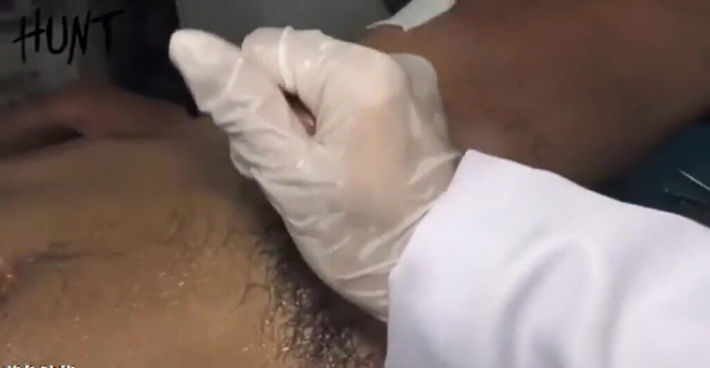 攝護腺密診 01